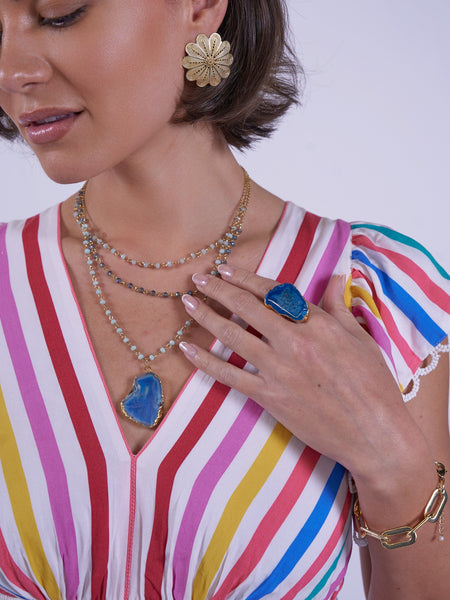 Misha Candy Stripe Dress